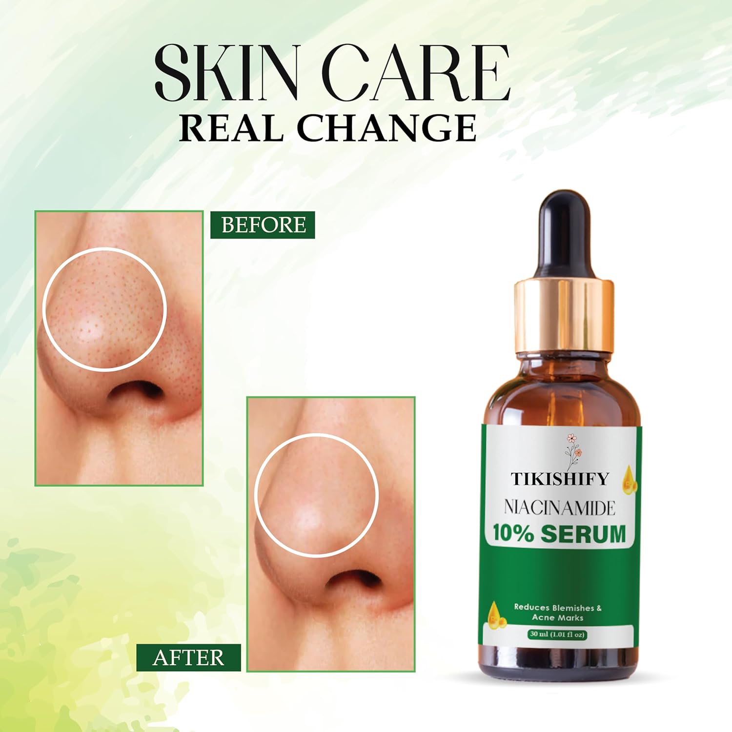 Niacinamide 10% Serum, Reduces Blemishes & Acne Marks, 30ml (1.01 fl oz)