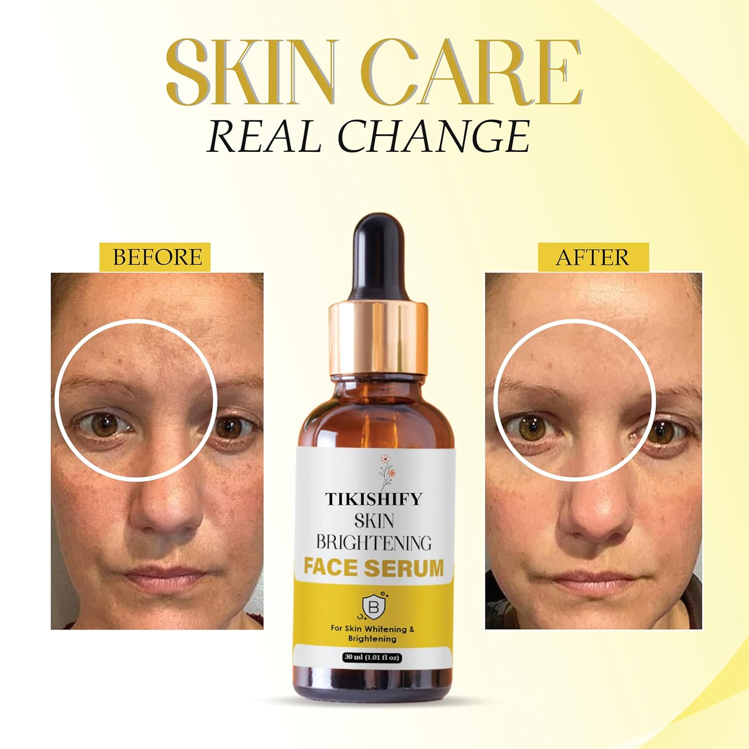 Skin Brightening Face Serum, For Skin Whitening & Brightening, 30ml (1.01 fl oz)